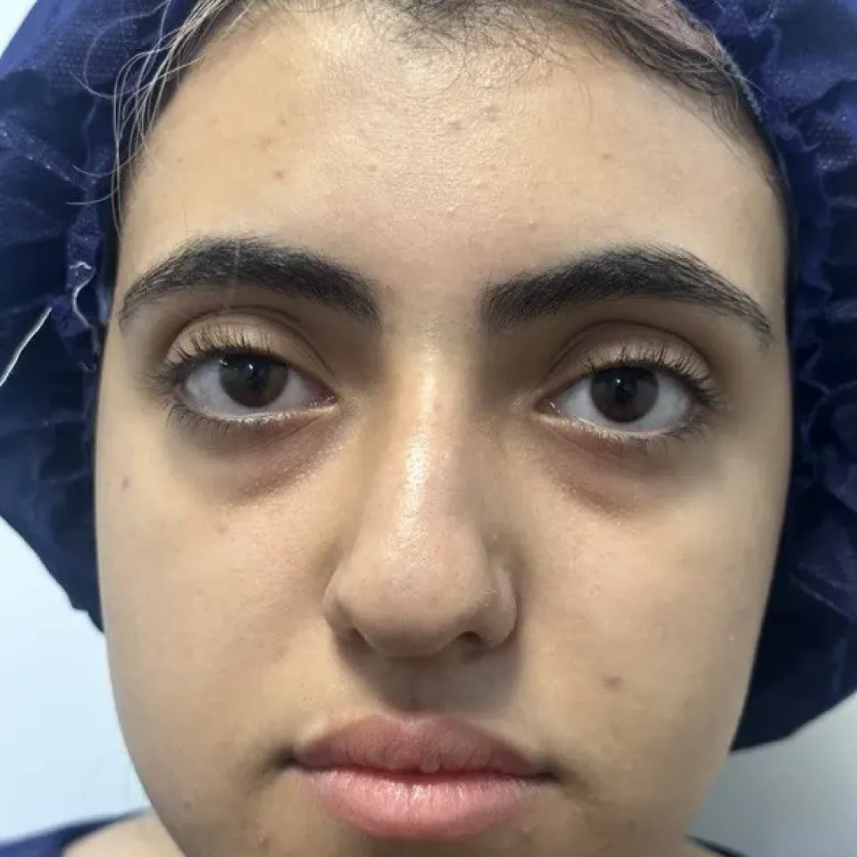 image (2)_11zon image (2)_11zon