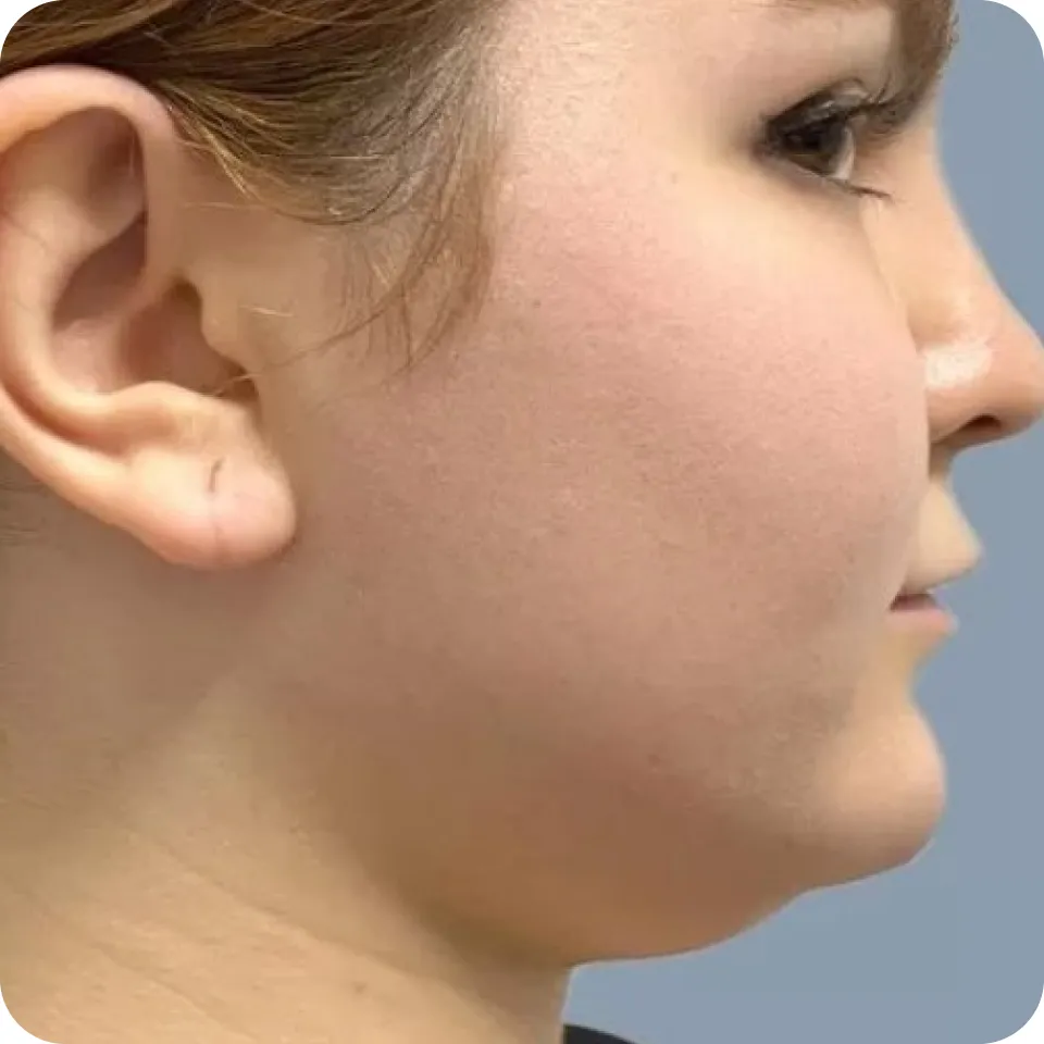 image13 (1)_11zon image13 (1)_11zon