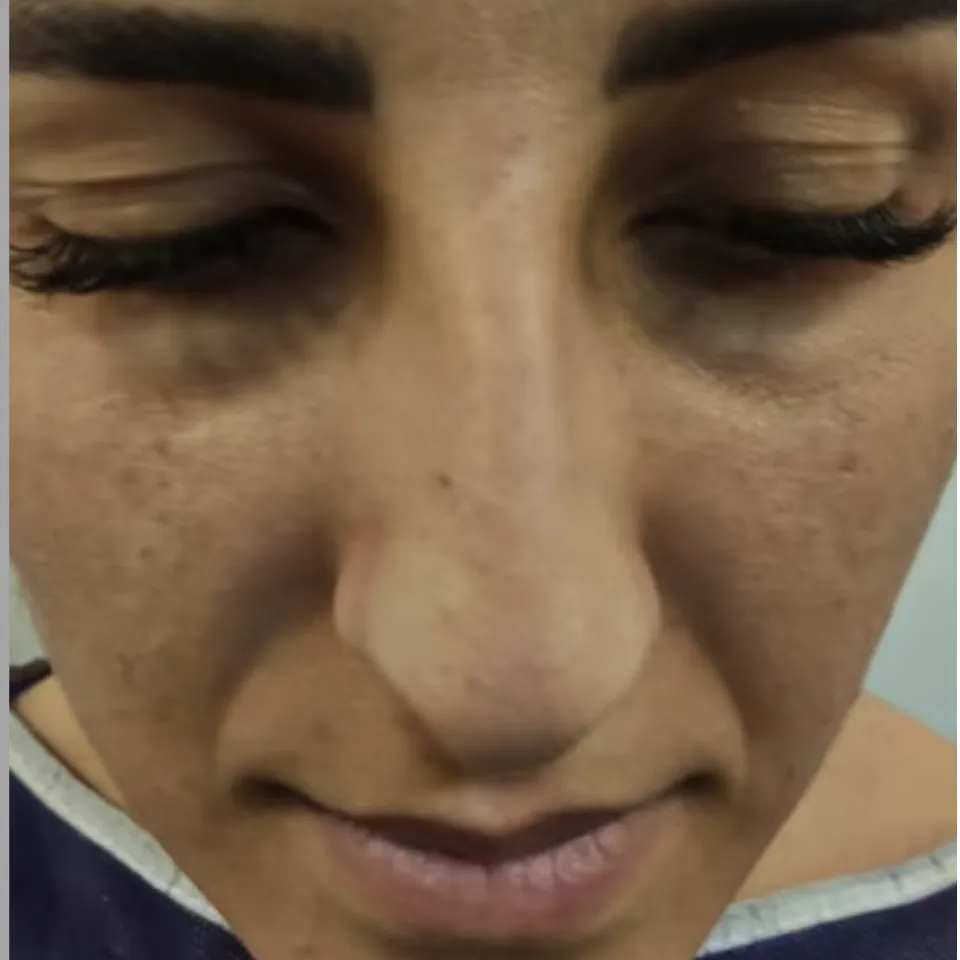 image_11zon image_11zon