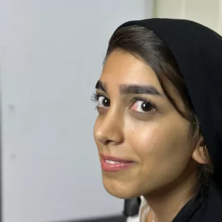 Rhinoplasty photo 13